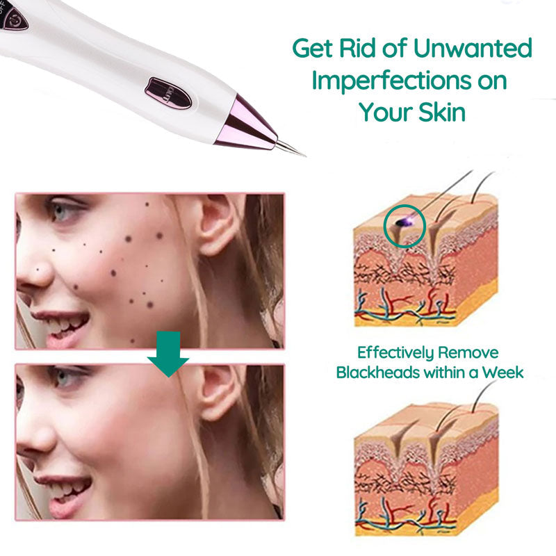 The Remover Pen™ for Moles