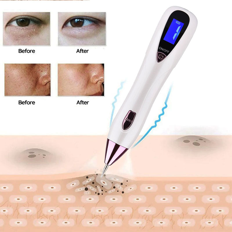 The Remover Pen™ for Moles